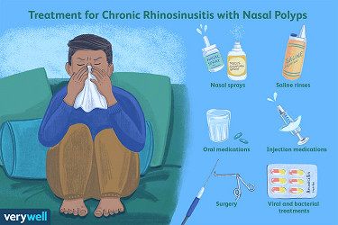Chronic Rhinosinusitis With Nasal Polyps